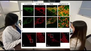 Variants in ATP5F1B are associated with dominantly inherited dystonia [upl. by Assyl]