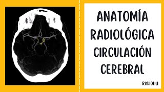 Anatomía Radiológica  Tomografía Computarizada Circulación cerebral [upl. by Callery]