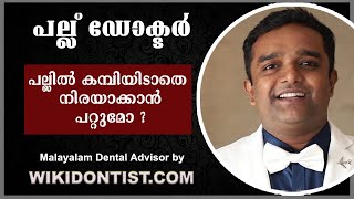 പല്ലിൽ കമ്പിയിടാതെ നിരയാക്കുവാൻ പറ്റുമോ  Malayalam Can We Straighten Teeth with out Braces [upl. by Amsirhc434]