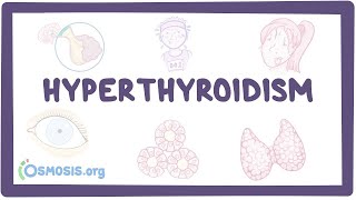 Hyperthyroidism  an Osmosis Preview [upl. by Mou]