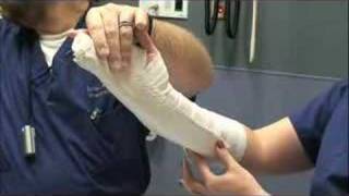 Ulnar Gutter Splint [upl. by Cavan]