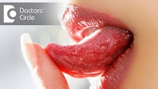 Common causes of ulcers on tongue in your 30s  Dr Aniruddha KB [upl. by Cotterell]