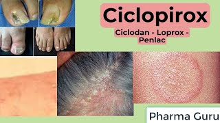 Ciclopirox  Ciclodan  Loprox  Penlac In a nutshell [upl. by Anaihsat]