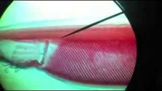 Anatomy of Amphioxus تشريح السهيم  YouTube [upl. by Diella]