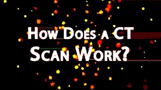 How does a CT work  CT scan working  computed tomography xray ctscane Radiographer2024 [upl. by Goltz]