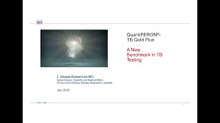 3QuantiFERONTB Gold Plus A New Benchmark in TB TestingDr Masae Kawamura [upl. by Sonahpets]