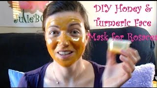 DIY Manuka Honey and Turmeric Face Mask for Rosacea and Redness  Rosy JulieBC [upl. by Eesdnil]