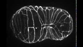 Epidermal morphogenesis of C elegans 線虫の表皮形態形成 [upl. by Cramer743]