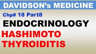 Davidsons Medicine Chp18 Part8  HASHIMOTO Thyroidits  Endocrinology  Dr Asif Lectures [upl. by Bonns]