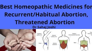 Best Homeopathic Medicines for RecurrentHabitual Abortion Threatened Abortion [upl. by Rube]