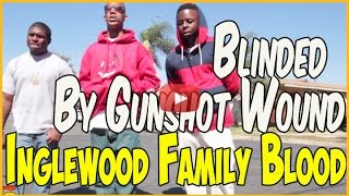 Munchie B from Inglewood Family Bloods lost vision after getting shot in head pt1of2 [upl. by Ltsyrk]