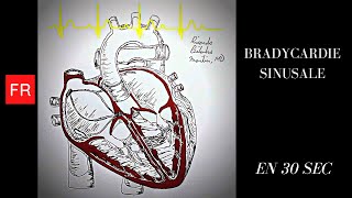 Arythmies Animation cardiaque et ECG  Bradycardie Sinusale Shorts [upl. by Eitsirc830]