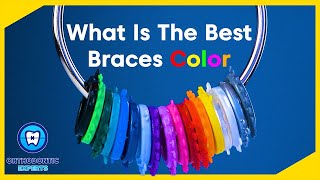 What are the BEST Braces Colors  Braces Color Ideas [upl. by Iron882]