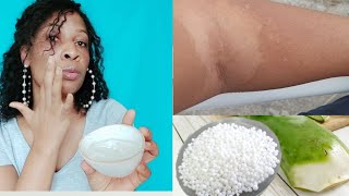 Recipe How to make an exfoliating urea and aloe vera Gel [upl. by Steep]