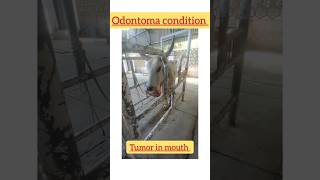 Tumor condition  Neoplasm  odontoma [upl. by Lorrayne]