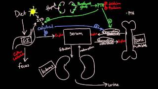 Hypercalcemia  causes symptoms diagnosis treatment pathology [upl. by Dasa]