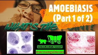 AMOEBIASIS Part 1 of 2  organism disease and pathophysiology [upl. by Edak]