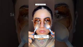 Remove Dark Circles Naturally At Home In 1DayUnderEye Dark Circles Remove Homeremedy dark shorts [upl. by Minnie312]