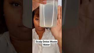 Seborrheic Dermatitis Scalp Detox Waste Water Keep your scalp healthy with scalp detox scalp [upl. by Annaert]