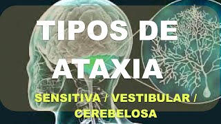 Ataxia Diagnóstico Diferencial Vestibular Sensitivo Cerebeloso [upl. by Caruso]