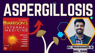 ASPERGILLOSIS  Pathogenesis  Clinical Features  Diagnosis  Treatment  Harrison [upl. by Oiramel939]