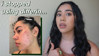 How to cure acne with DIFFERIN GEL adapalene gel 01 Review acnetreatment differingel adapalene [upl. by Arekahs]