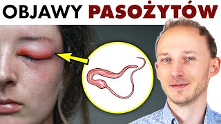 Objawy pasożytów w ciele  i co robić by ich nie złapać  Dr Bartek Kulczyński [upl. by Birkett]