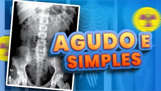 DIFERENÇA ENTRE ABDOME SIMPLES E ABDOME AGUDO  Radiologando [upl. by Esinet]