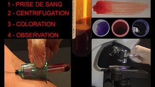 Prise de sang humain  Centrifugation  Frottis  Coloration  Observation SVT Hervé Kempf [upl. by Nnylrebma]