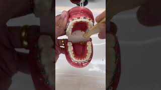 How to Brush your teeth when you have Braces on braces brush [upl. by Stubbs]