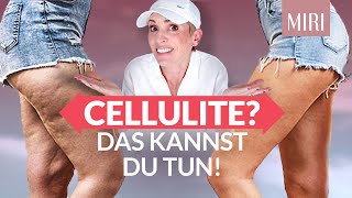 Die besten Tipps Das solltest Du wissen [upl. by Odanref]