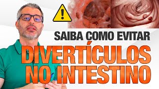 O que você precisa saber para não ter uma DIVERTICULITE [upl. by Aitnas]