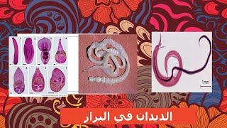 parasitology 3 helminths فحص البراز الطفيليات [upl. by Berck]