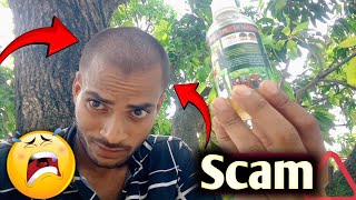 Aadivasi Hair oil scam  ye kya ho gaya mere sath 😳  results after 15 days 🤡 [upl. by Galatia160]