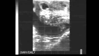 Bovine fetal age quiz final questions from BCF Technology HD [upl. by Heyward]