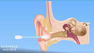 Forget QTips — Here’s How You Should Be Cleaning Your Ears [upl. by Aicatsal]