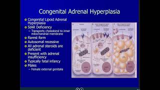 Congenital Adrenal Hyperplasia [upl. by Sokim376]