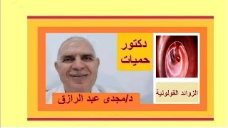 الزوائد القولونية والأورام الحميدة [upl. by Atilam]