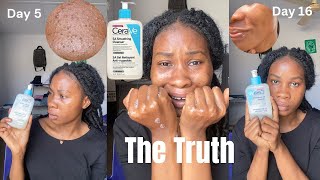 I TRIED CeraVe SA Smoothing Cleanser for 30 Days and This Happened Honest Review [upl. by Htebzile15]