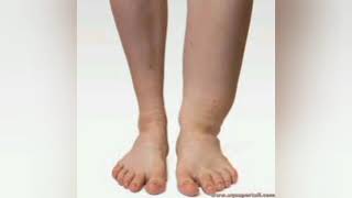 TOP 5 NUTRIMENTS POUR RÉDUIRE LE GONFLEMENT DES PIEDS ET DES JAMBES [upl. by Cohin]