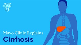 Mayo Clinic Explains Cirrhosis [upl. by Ollehto]