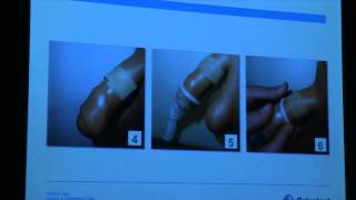 Symposium urologie prostaatkanker 6 december 2014  Anne Neirynck [upl. by Oilejor]