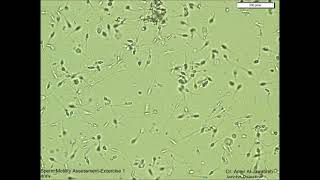 Sperm Motility Assessment exercise 1 [upl. by Iznek425]