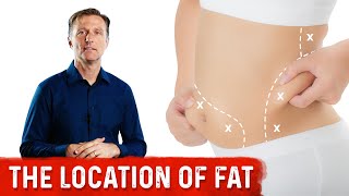 Body Fat Location Can Predict Disease [upl. by Nnylrefinnej]