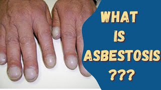 Asbestosis Asbestos disease Sign amp Symptoms Causes and risks [upl. by Leinahtam]