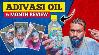 Adivasi hair oil 6 month review finally review💯 क्या हमें लेना चाहिए या नहीं [upl. by Mathilda733]