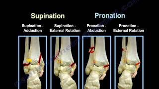 Ankle Fractures Lauge Hansen Introduction  Everything You Need To Know  Dr Nabil Ebraheim [upl. by Lette]