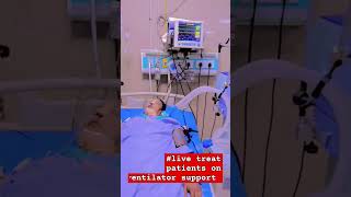 live treat patients on ventilator support short [upl. by Atarman]