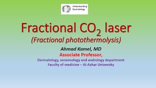 Fractional CO2 laser Fractional photothermolysis [upl. by Wilkinson]