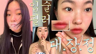 vlog 입술필러 녹이고 다시 맞고온 후기💉💋 입술필러 대장정😱 가격•고통•부작용•붓기••• [upl. by Alekehs9]